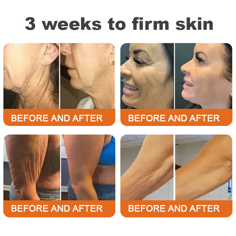 ✨Flysmus® Botox Bee Venom Firming Serum Stick-(Made and Shipped from Australia)-LAST DAY 70% OFF