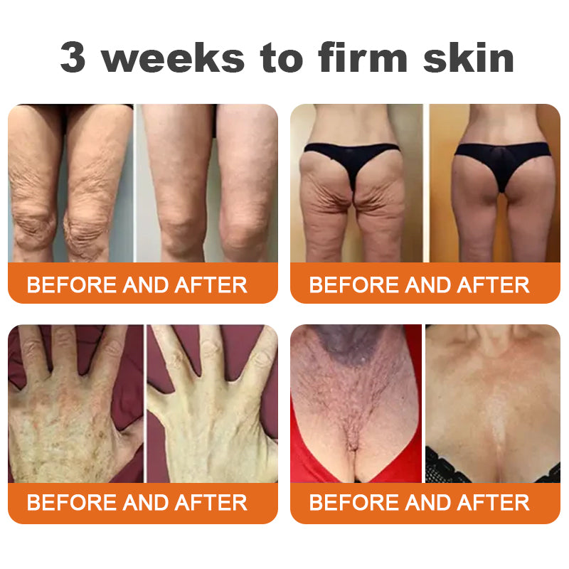 ✨Flysmus® Botox Bee Venom Firming Serum Stick-(Made and Shipped from Australia)-LAST DAY 70% OFF